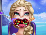 Elsa baktériumos szája jégvarázs játék